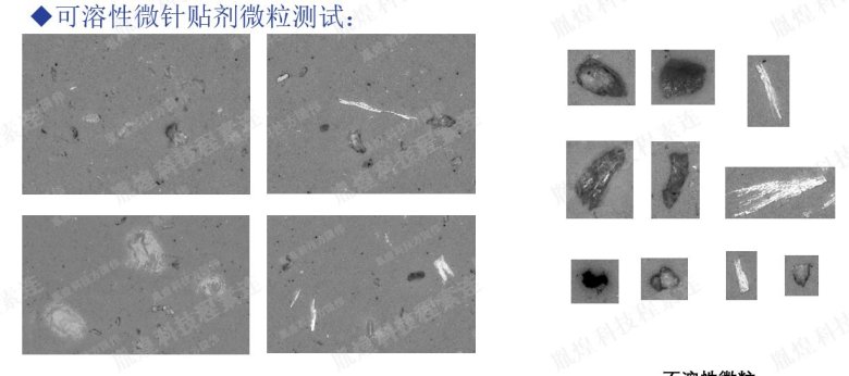 可溶性微针贴剂